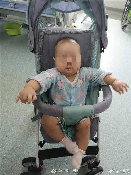 11個月的女兒肝臟硬化 29歲媽媽義無反顧捐肝