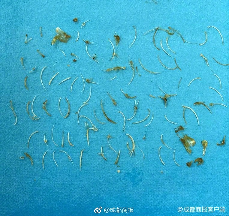 49歲陳浩民曬針頭戳眉照承認微整：不做很吃虧