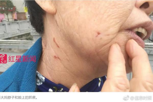張丹峰辟謠后洪欣首次現(xiàn)身